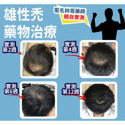 雄性禿